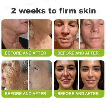 💎Made and shipped from Australia  Rolimey® Botox & Vita-A Retinol Shot Wrinkle-Lift Tightening cream - Last Day Promotion 70% OFF|