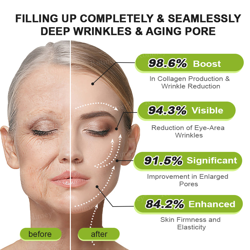 💎Made and shipped from Australia  Rolimey® Botox & Vita-A Retinol Shot Wrinkle-Lift Tightening cream - Last Day Promotion 70% OFF|