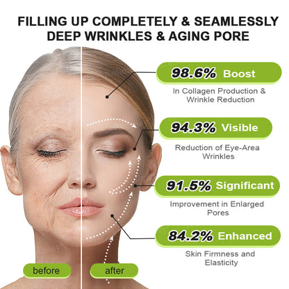 💎Made and shipped from Australia  Rolimey® Botox & Vita-A Retinol Shot Wrinkle-Lift Tightening cream - Last Day Promotion 70% OFF|