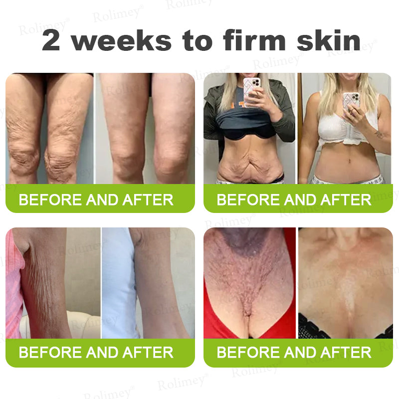 💎Made and shipped from Australia  Rolimey® Botox & Vita-A Retinol Shot Wrinkle-Lift Tightening cream - Last Day Promotion 70% OFF|