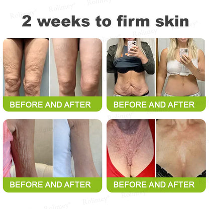 💎Made and shipped from Australia  Rolimey® Botox & Vita-A Retinol Shot Wrinkle-Lift Tightening cream - Last Day Promotion 70% OFF|